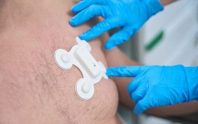 Key Considerations for Achieving Optimal Stick-to-Skin Adhesion for Wearable Devices