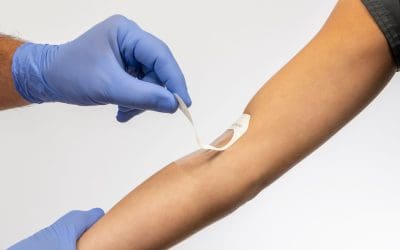 Unleashing the Potential of Pattern Printed Adhesive Capabilities for Medical Devices